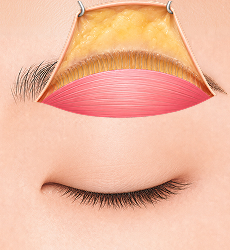 눈썹하거상 STEP 2