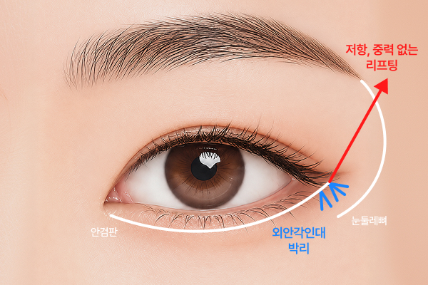 실리프팅 사진