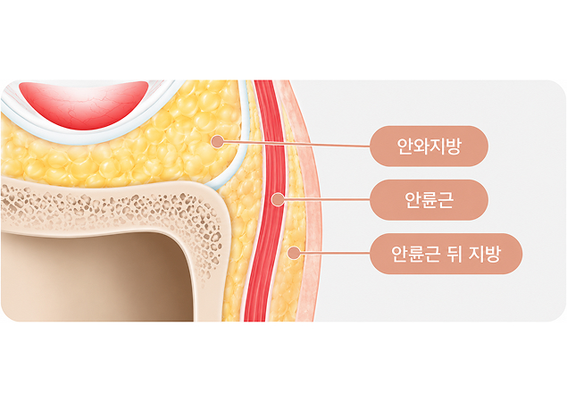 필요한 만큼만 적정 층에 주입