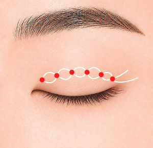 자연유착 STEP 3