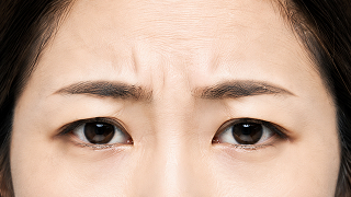 미간, 이마 주름