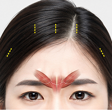 원앤온리 내시경 이마거상 STEP 3