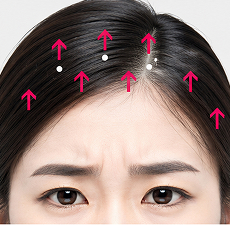 원앤온리 내시경 이마거상 STEP 4