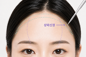 원앤온리 내시경 이마거상 STEP 1