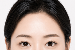 원앤온리 내시경 이마거상 STEP 3