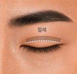 라인낮추기 STEP 3