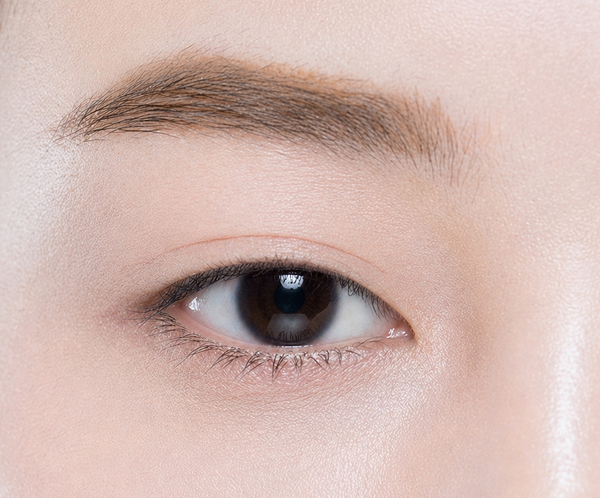 풀린 눈