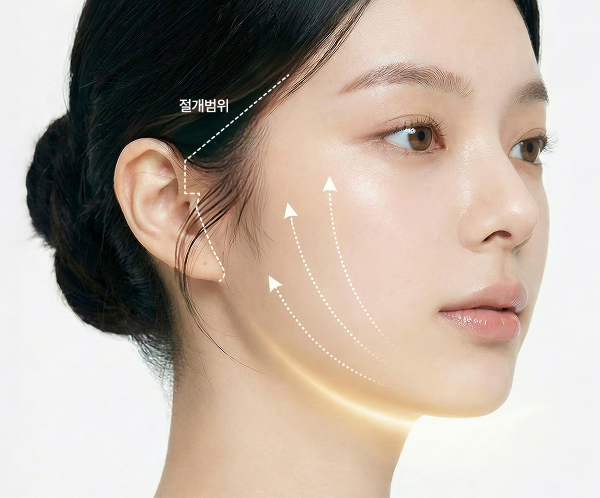 O2 연조직윤곽술