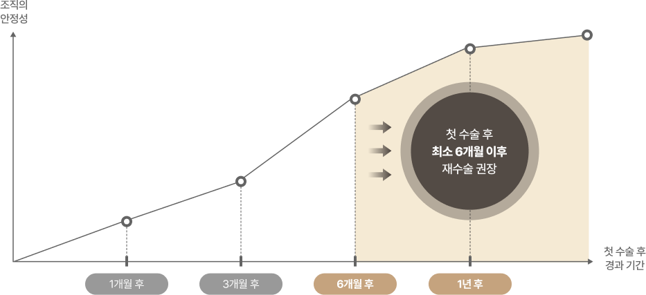 수술시기 이미지