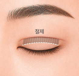 라인낮추기 STEP 3