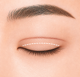 두줄따기 STEP 2
