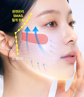 원앤온리 O2 스마스 테크닉