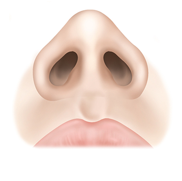 정상