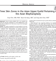 Three Skin Zones in the Asian Upper Eyelid  Pertaining to the Asian Blepharoplasty